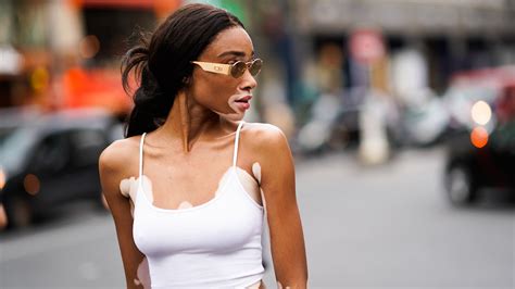 winnie harlow nude|Winnie Harlow Opens Up About Vitiligo & Posing Nude for The。